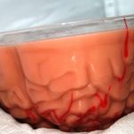 Cervello in bellavista