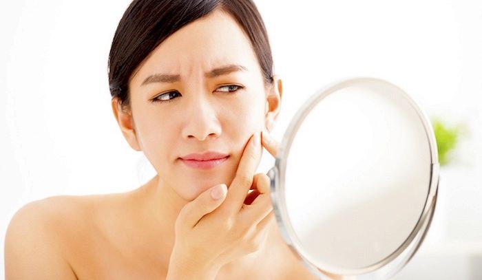Acne, incubo dei nostri ragazzi