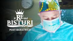 Il re del bisturi post bariatrico