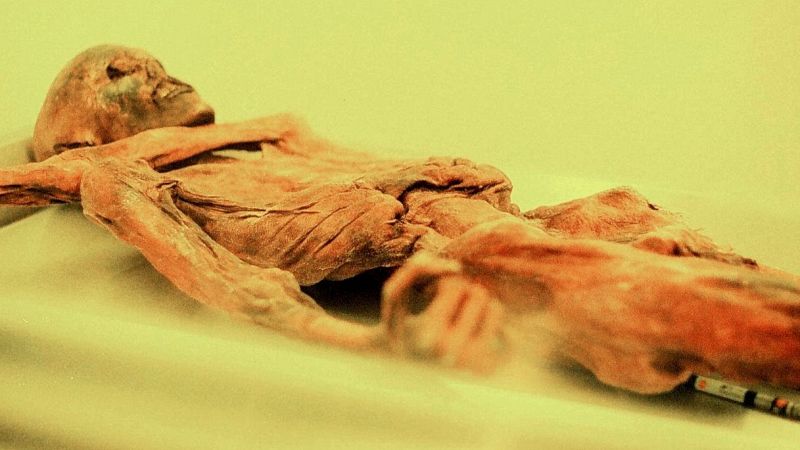 Otzi
