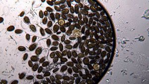 Alga tossica