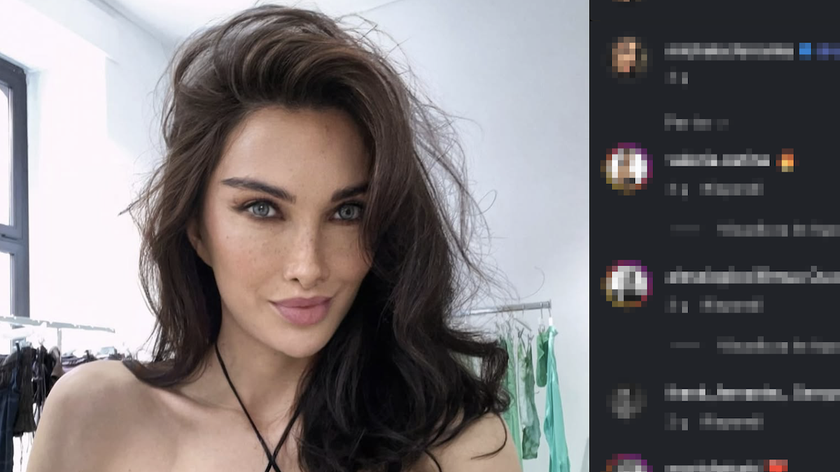 Michela Ferrante, chi è la modella che ha perso la vista periferica (per errore): il tentato suicidio e lo sfogo in tv