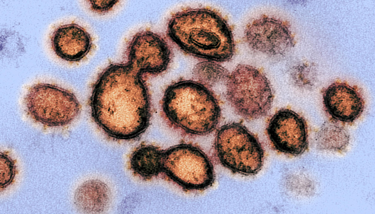Coronavirus, come è fatto: l'infezione in 3D