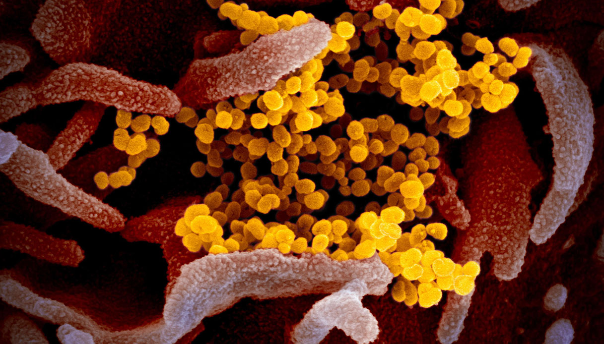Coronavirus, come è fatto: l'infezione in 3D
