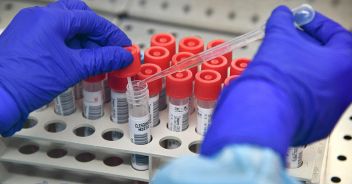 Ho incontrato un positivo test online calcola le probabilità