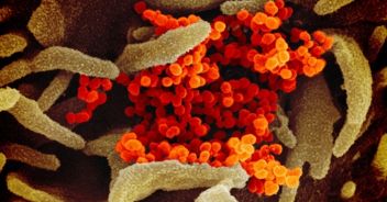 Coronavirus, verso un vaccino jolly contro future pandemie