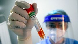 Covid, um estudo de associações entre vacina e "morte súbita"Sem aumento de ataques cardíacos, derrames e miocardite