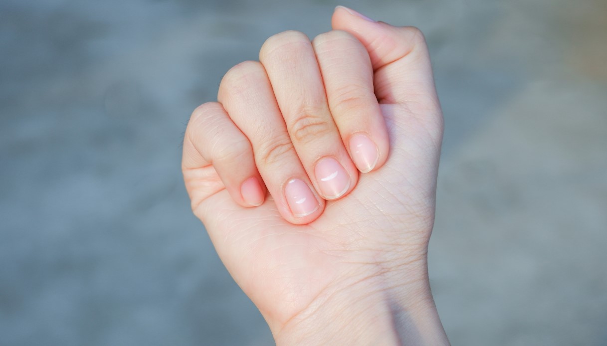 Infarto, il segnale che arriva dalle unghie: come riconoscere che puoi essere a rischio di attacchi di cuore