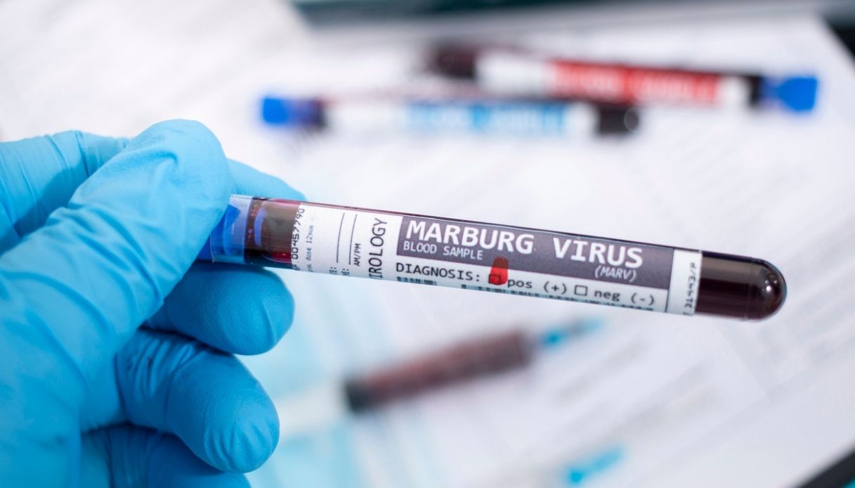 Virus Marburg, dichiarato primo focolaio in Ghana. L'allarme: 