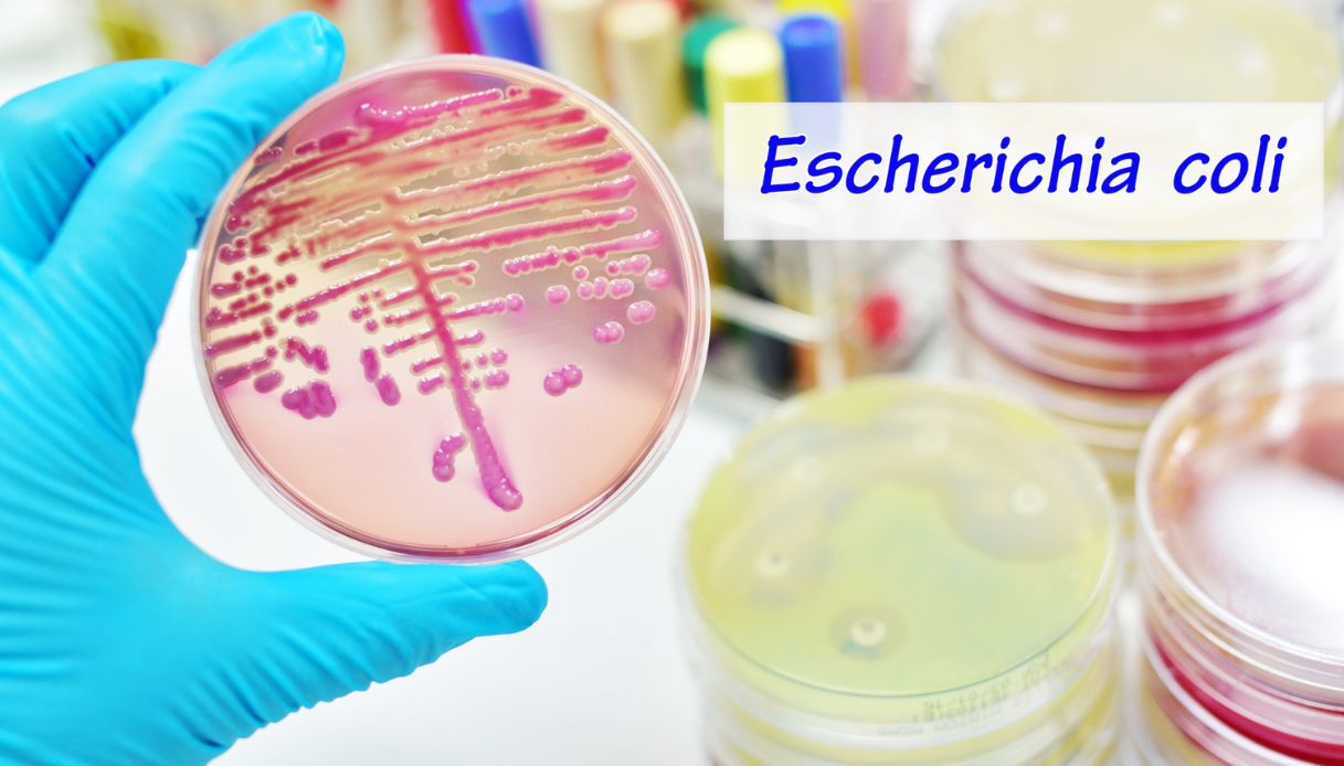 Escherichia coli