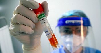 Covid circolare Ministero