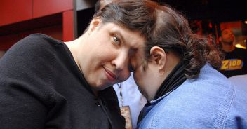 schappell-gemelli-siamesi