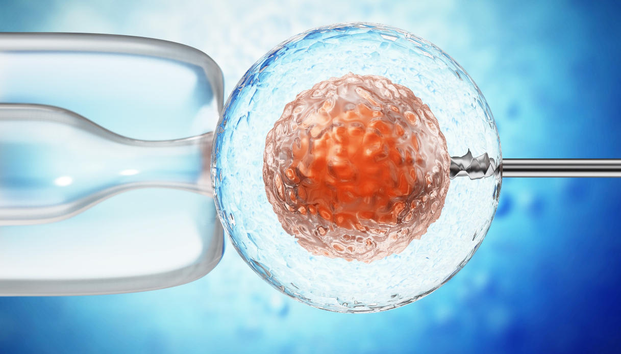 Illustrazione 3D del processo di inseminazione artificiale che mostra gli spermatozoi iniettati all'interno dell'ovulo.