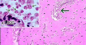 ameba-mangia-cervello-sintomi-naegleria-fowleri-cura