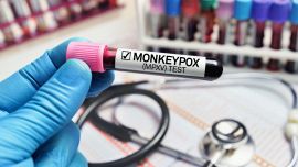 Monkeypox: ¿Puedes decir quién se enfermará gravemente? Estudio italiano sobre la suspensión Mbox y Bassetti