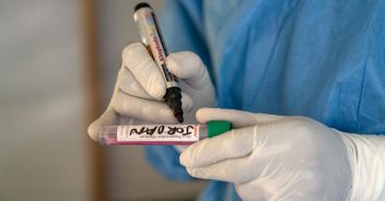 vaiolo-delle-scimmie-oms-mpox