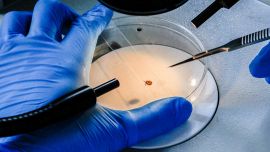 Virus delle zecche, Wetland in Cina mentre in Italia preoccupa la meningite TBE: i rischi e come difendersi