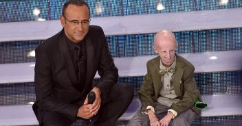 sammy-basso-progeria