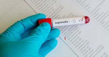 legionella-cesano-boscone-milano