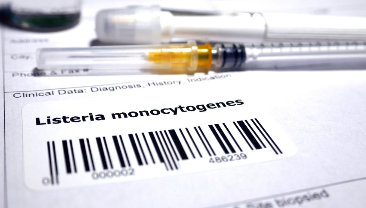 Città di Castello coppa maiale Listeria monocytogenes