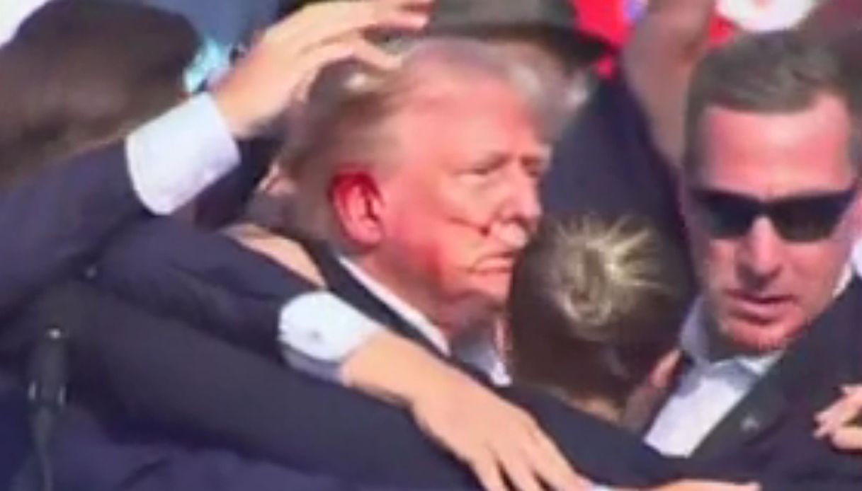 Donald Trump cicatrici