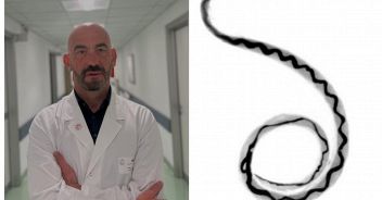 lumache-killer-cani-uomo-bassetti