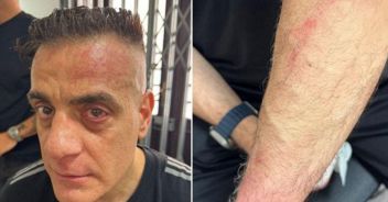 simone-cicalone-aggredito-napoli