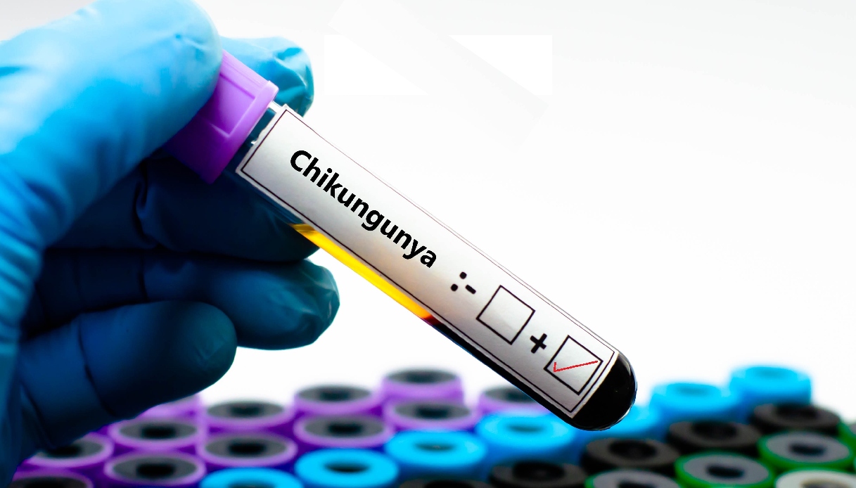 https://wips.plug.it/cips/notizie.virgilio.it/cms/2025/07/virus-chikungunya-italia.jpg