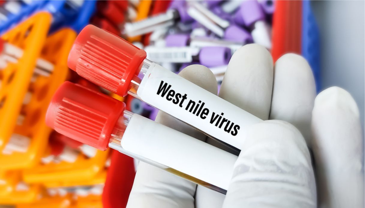 virus West Nile zanzare Pregliasco