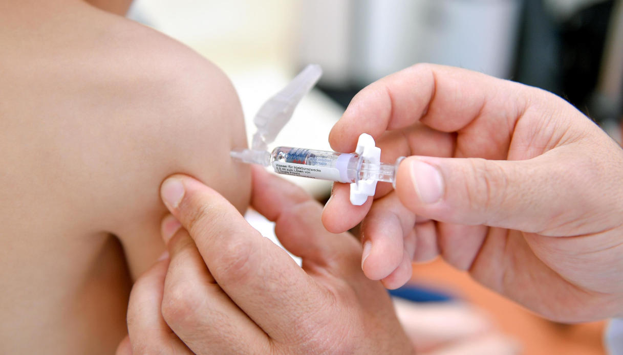 Morbillo in Italia contagi