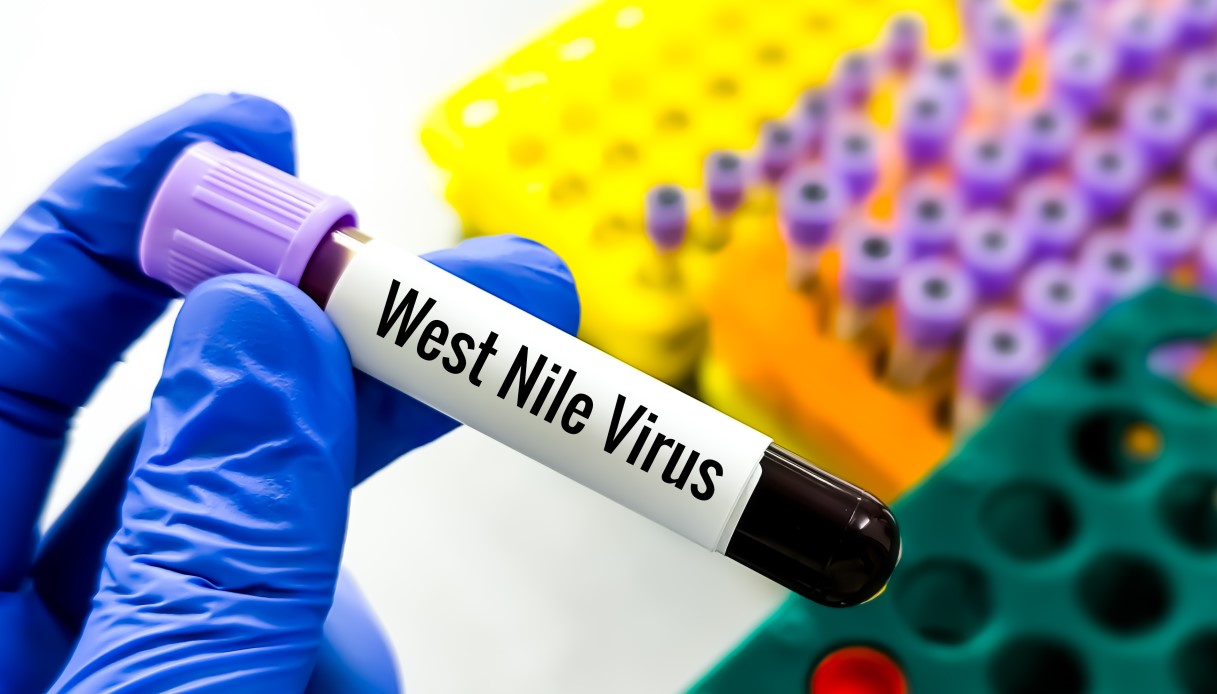 virus West Nile