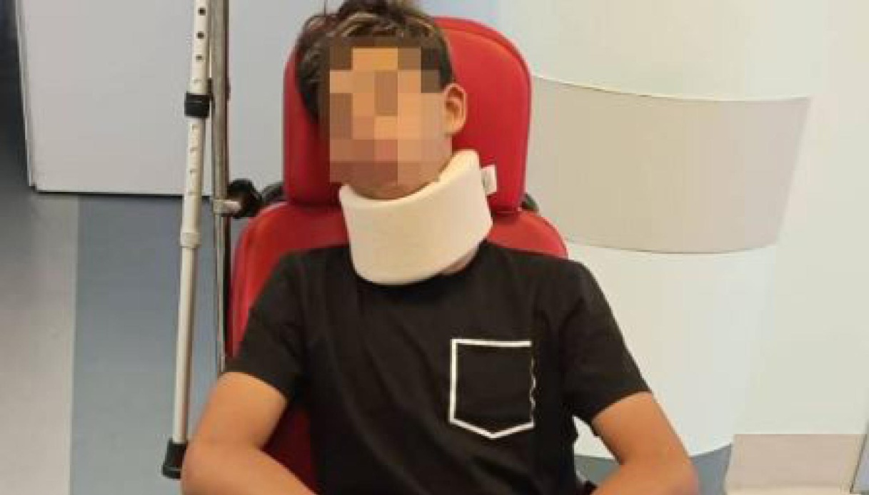 Picchiato a Collegno nella rissa dopo la partita, papà del 13enne replica e accusa il genitore avversario Picchiato a Collegno nella rissa dopo la partita, papà del 13enne replica e accusa il genitore avversario