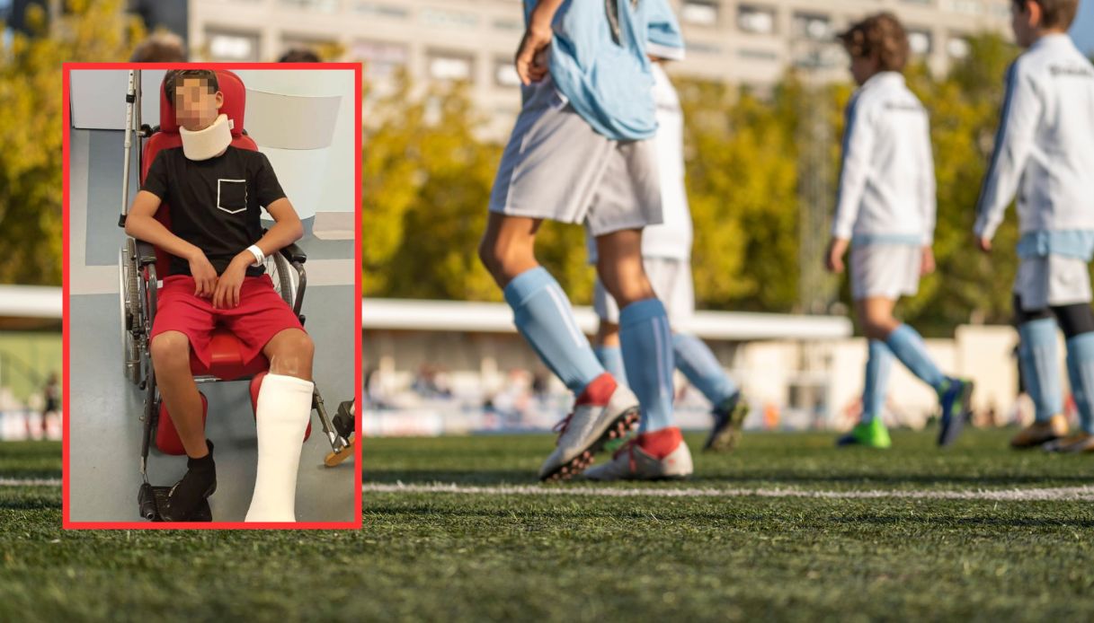 Giovane portiere picchiato a Collegno dal papà dell