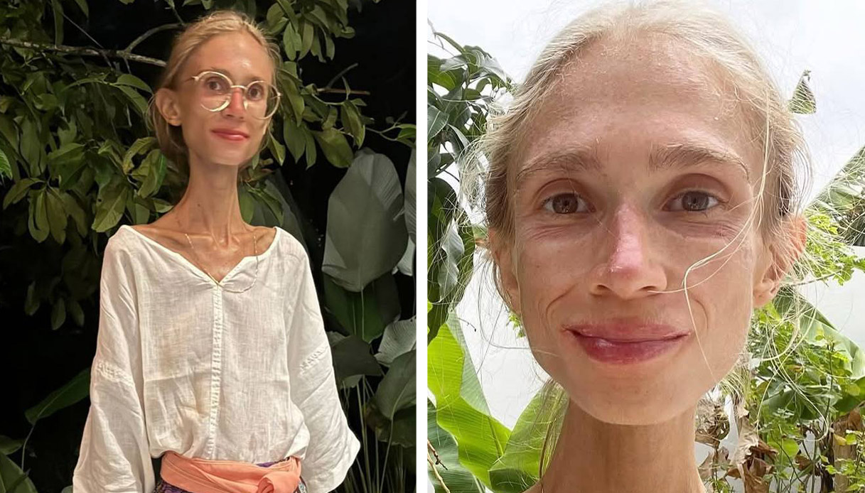 https://wips.plug.it/cips/notizie.virgilio.it/cms/2025/10/influencer-karolina-krzyzak-morta-bali-dieta.jpg