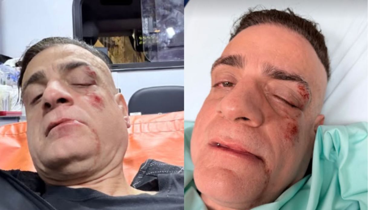 Simone Cicalone aggredito nella metro di Roma, lo youtuber anti borseggiatori pestato a sangue