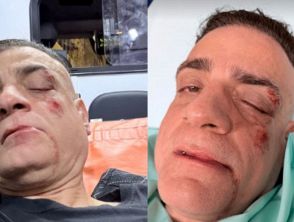 Simone Cicalone aggredito nella metro di Roma, lo youtuber anti-borseggiatori pestato a sangue