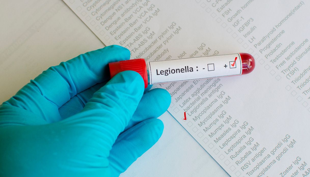 legionella