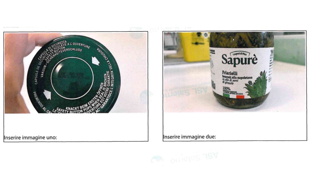 friarielli Sapur&egrave; botulino