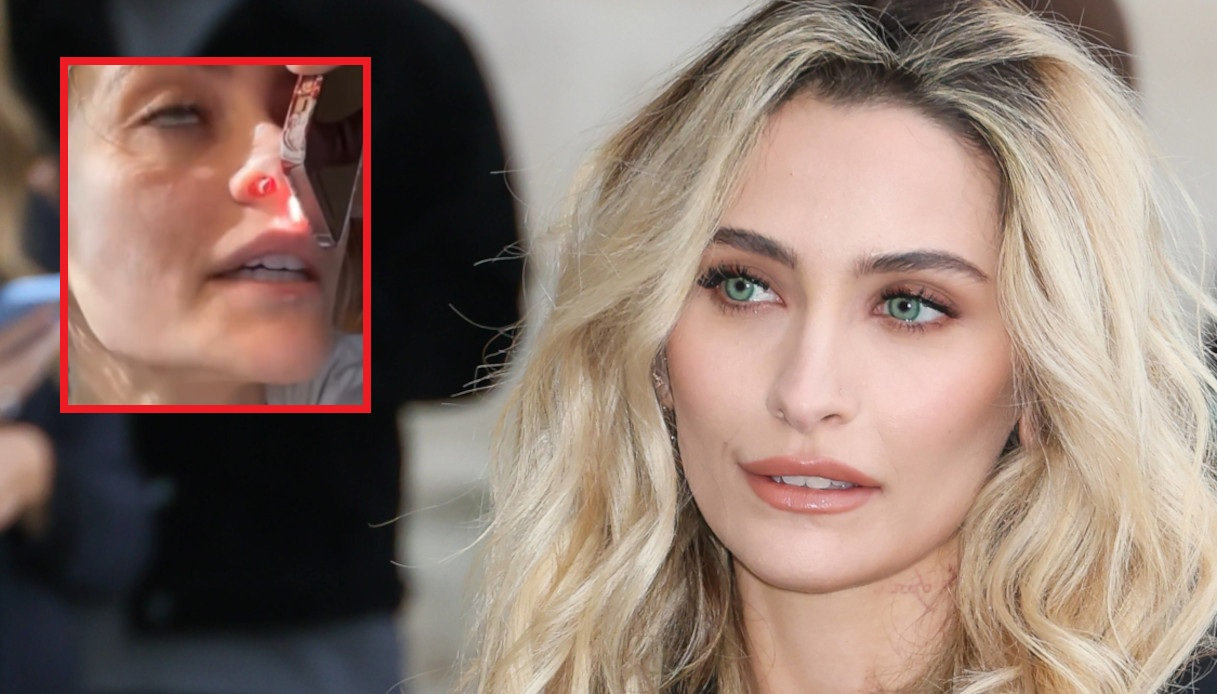 https://wips.plug.it/cips/notizie.virgilio.it/cms/2025/11/paris-jackson-naso-setto-nasale.jpg