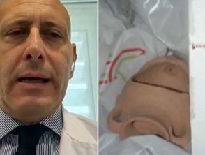 Garlasco, il mistero dell'impronta 97F lasciata forse dall'assassino di Chiara Poggi: 