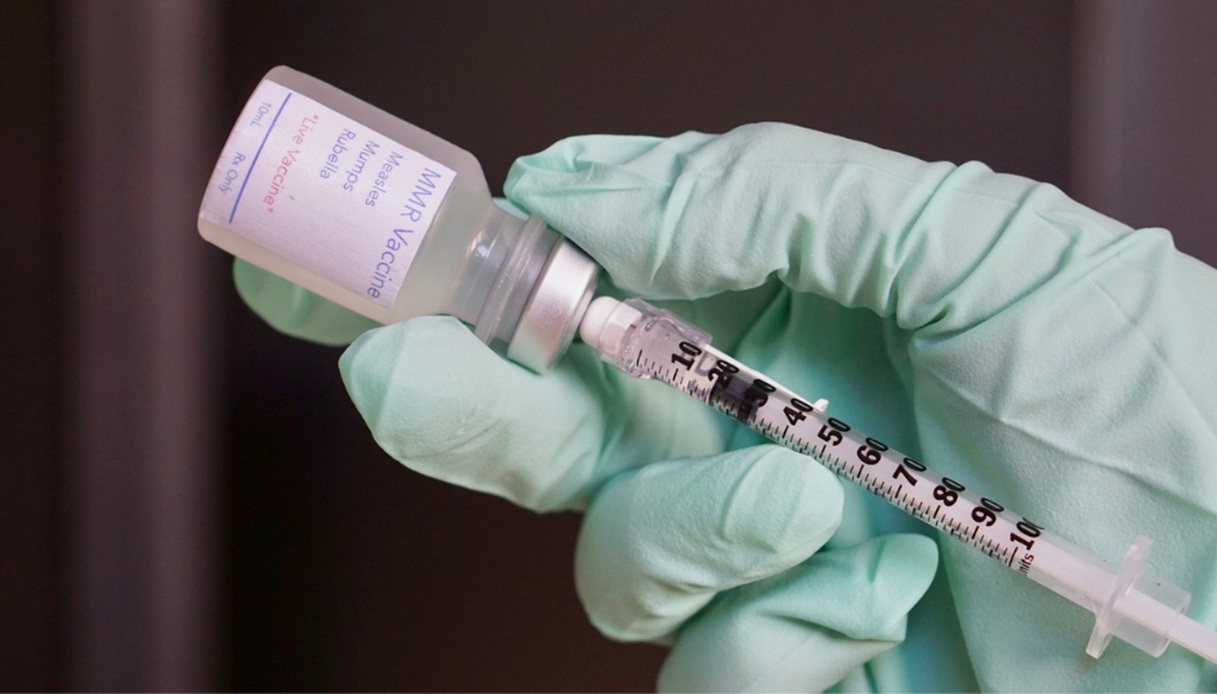 https://wips.plug.it/cips/notizie.virgilio.it/cms/2026/05/epidemia-morbillo.jpg