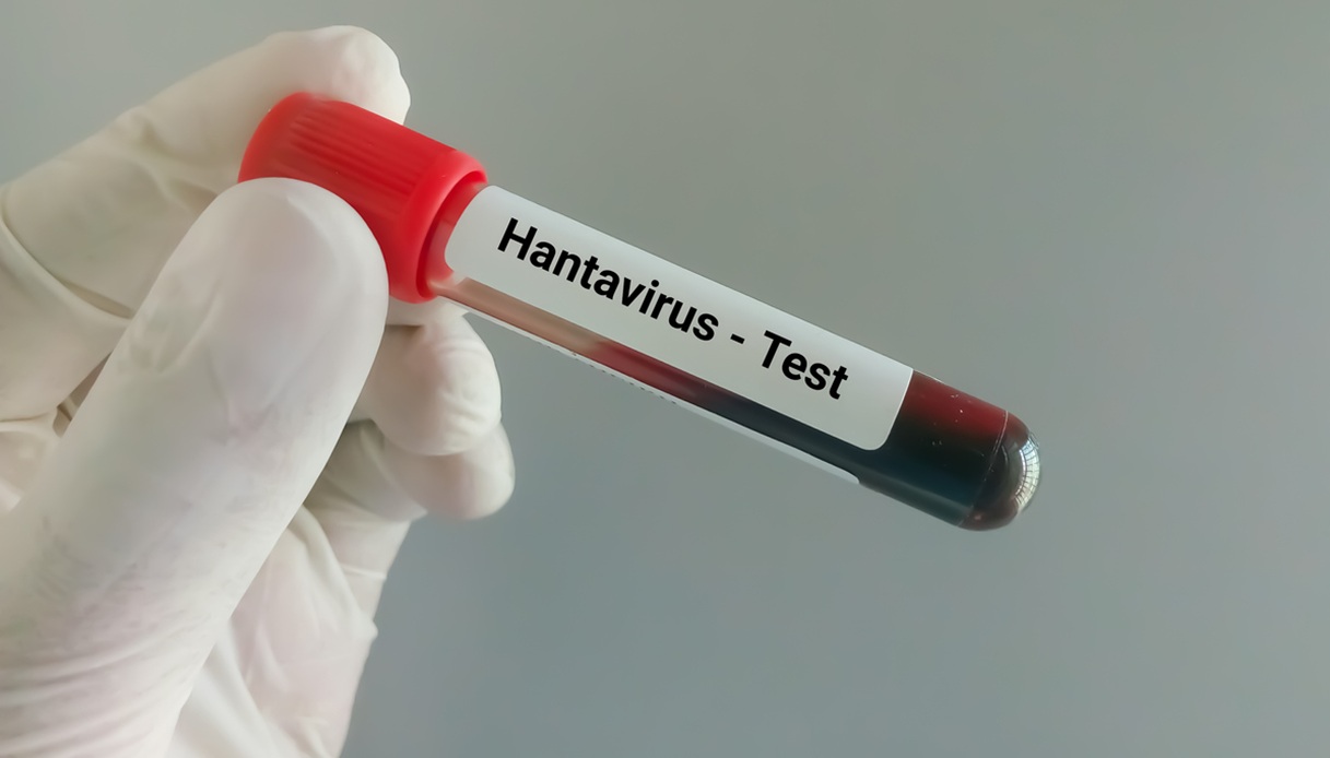 https://wips.plug.it/cips/notizie.virgilio.it/cms/2026/05/hantavirus-infezione-sintomi-come-curarlo.jpg