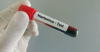 hantavirus-infezione-sintomi-come-curarlo