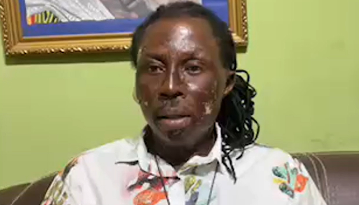 chi 232 lo stregone nana kwaku bonsam che vuole fermare kane in inghilterra ghana le ustioni e il soprannome da Virgilio.it chi 232 lo stregone nana kwaku bonsam che vuole fermare kane in inghilterra ghana le ustioni e il soprannome