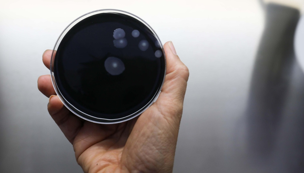 cos 232 la legionella i sintomi e i rischi del batterio che pu242 arrivare in casa attraverso i condizionatori da Virgilio.it cos 232 la legionella i sintomi e i rischi del batterio che pu242 arrivare in casa attraverso i condizionatori