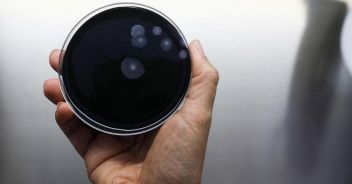 cos-e-legionella-sintomi-rischi-batterio