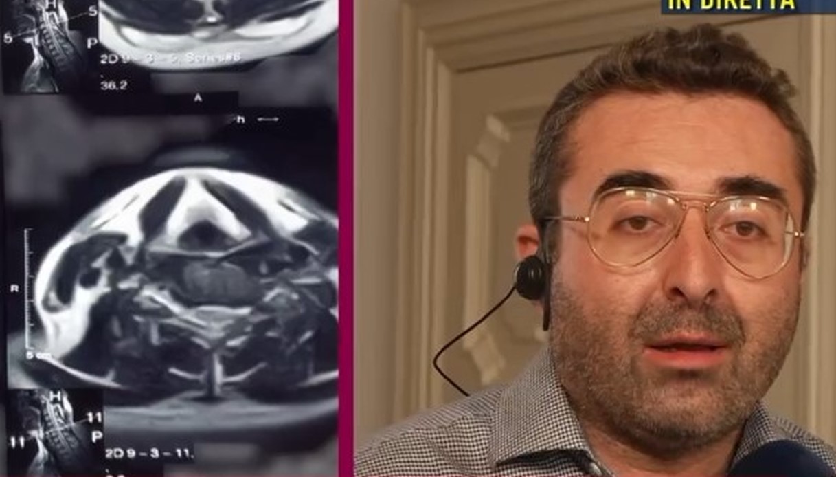 pamela genini francesco dolci denuncia foto sospette di una tac alla testa ricevute da un numero anonimo da Virgilio.it pamela genini francesco dolci denuncia foto sospette di una tac alla testa ricevute da un numero anonimo