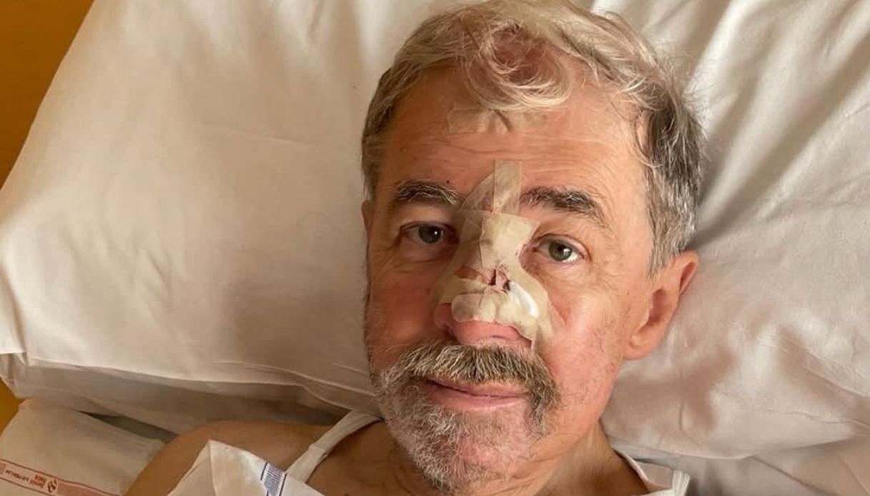 marco bucci operato per un basalioma come si riconosce il tumore della pelle pi249 diffuso sintomi e cure da Virgilio.it marco bucci operato per un basalioma come si riconosce il tumore della pelle pi249 diffuso sintomi e cure