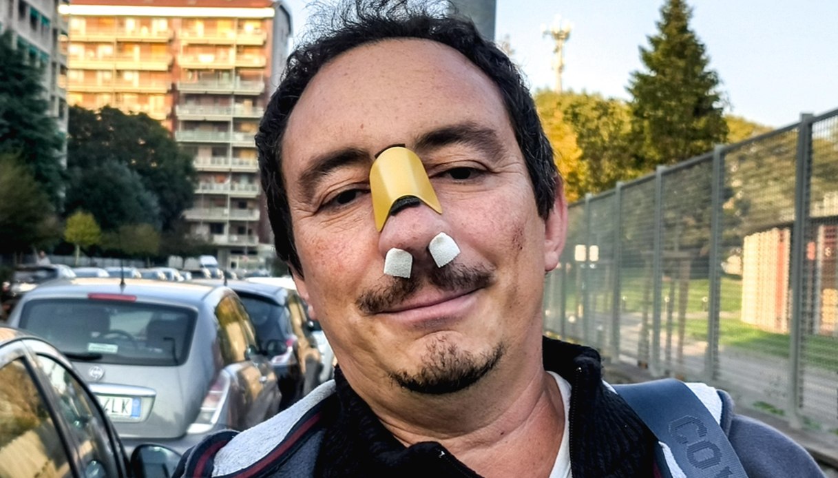 professore bruno vadal224 aggredito dallo studente al carlo grassi di torino violenza immotivata da Virgilio.it professore bruno vadal224 aggredito dallo studente al carlo grassi di torino violenza immotivata
