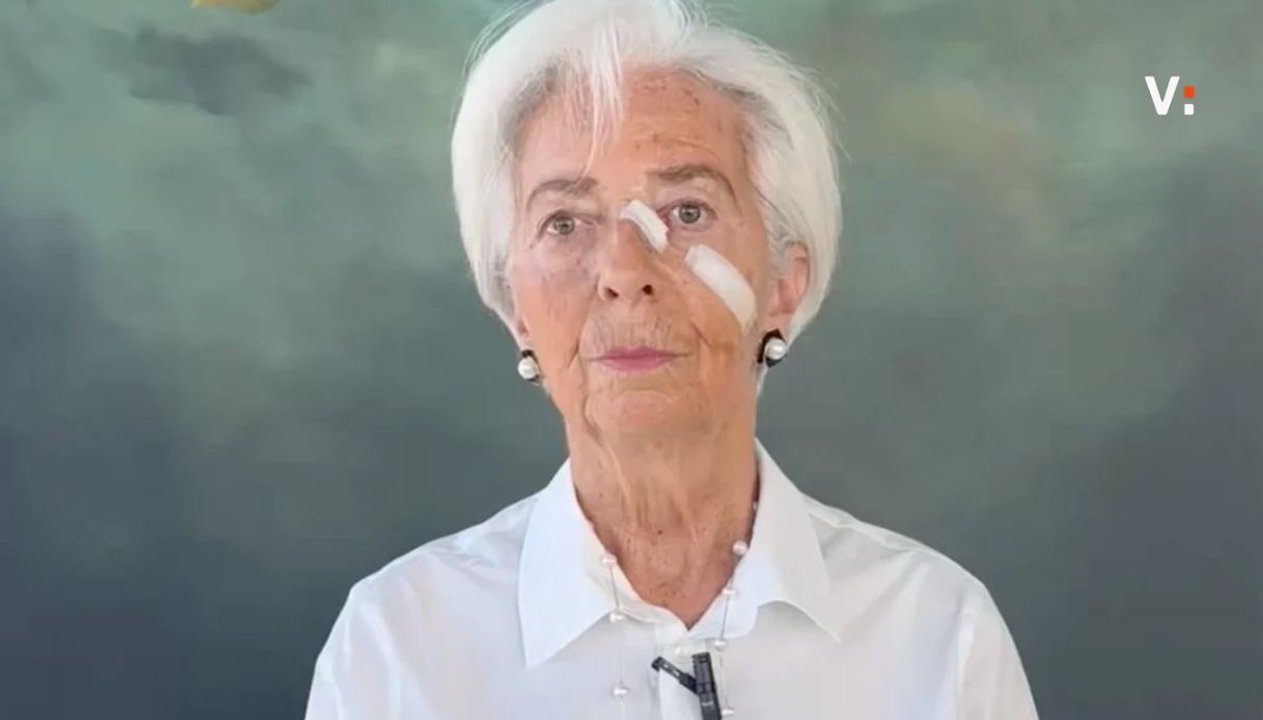 christine lagarde e il mistero sui cerotti sul viso nel video delle dimissioni piccolo intervento da Virgilio.it christine lagarde e il mistero sui cerotti sul viso nel video delle dimissioni piccolo intervento